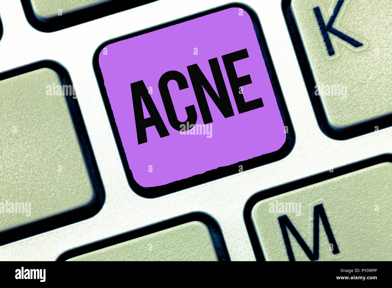 Conceptual hand writing showing Acne. Business photo showcasing Skin ...