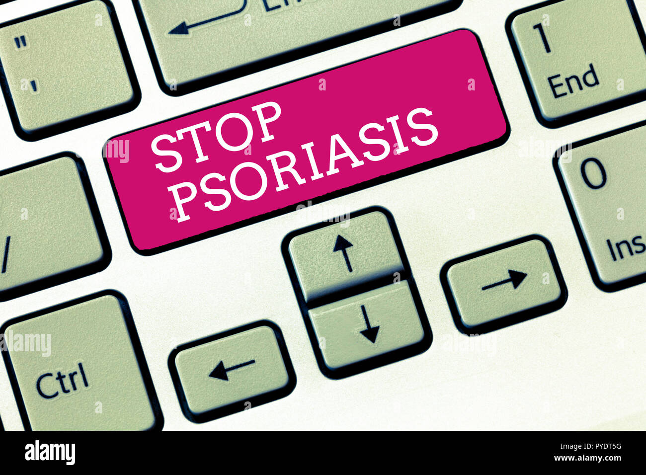 Handwriting Text Stop Psoriasis Concept Meaning End The Disorder That Causes The Rapid Buildup Of Skin Cells Stock Photo Alamy