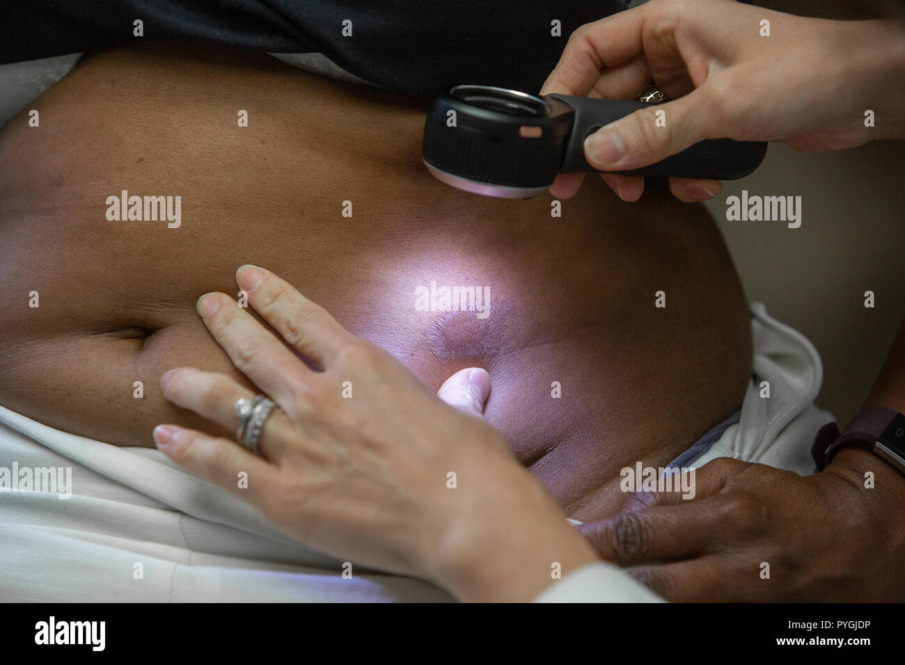 Doctor examines patient for skin disease Stock Photo