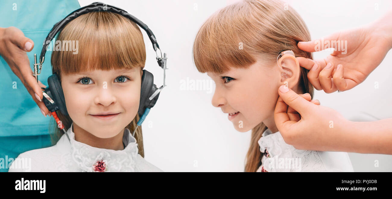 Collage little girl wearing headphones getting a hearing test and after hearing test, doctor places a hearing aid in her ear. Stock Photo