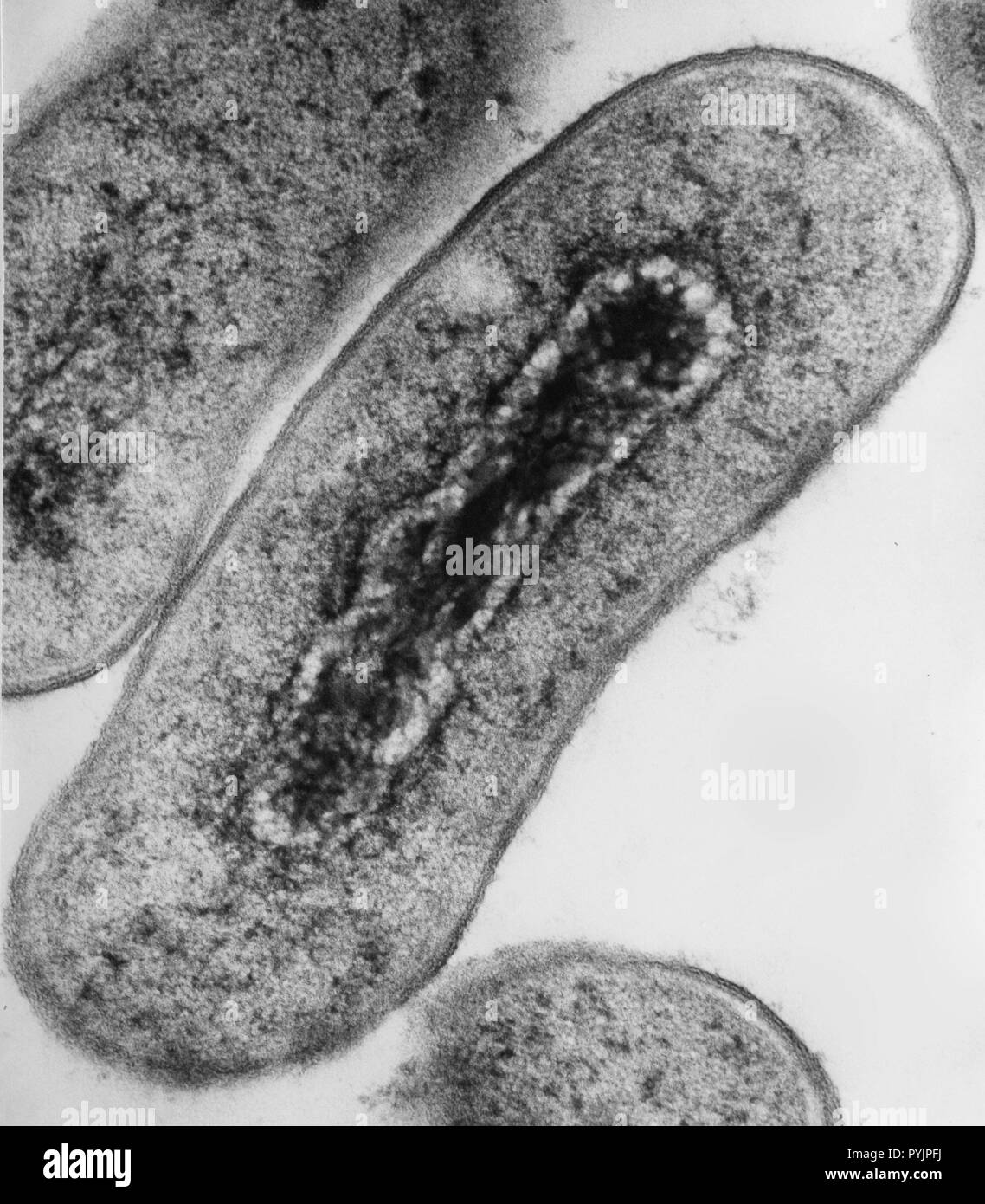 Electron micrograph cross section of Escherichia coli bacteria Stock Photo