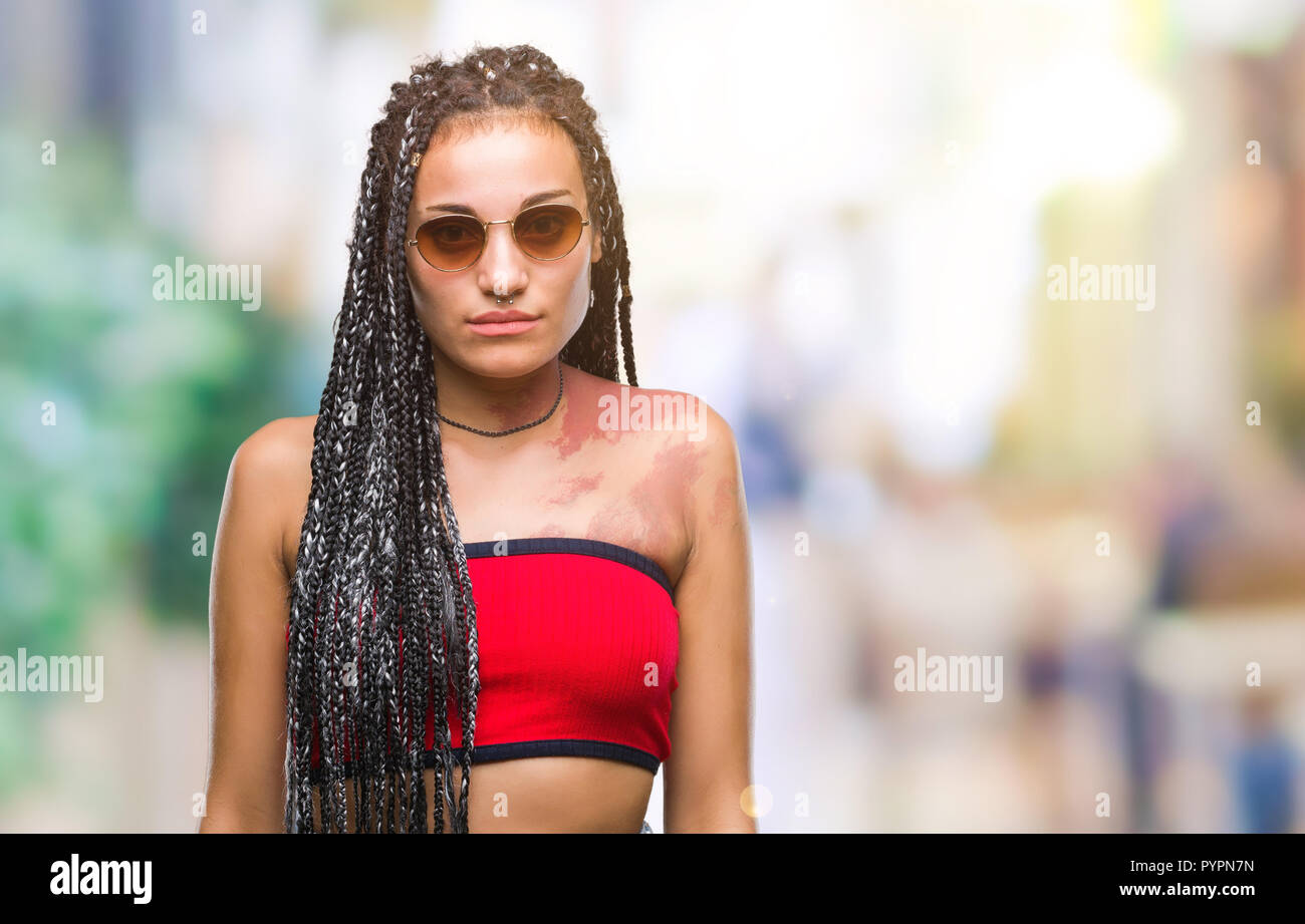 Young Braided Hair African American With Birth Mark Wearing