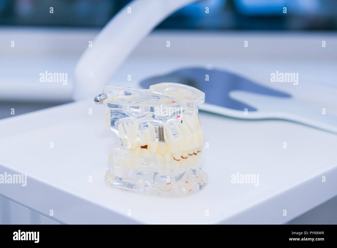 Close up glass jaw model with implanted dentures on the working dental