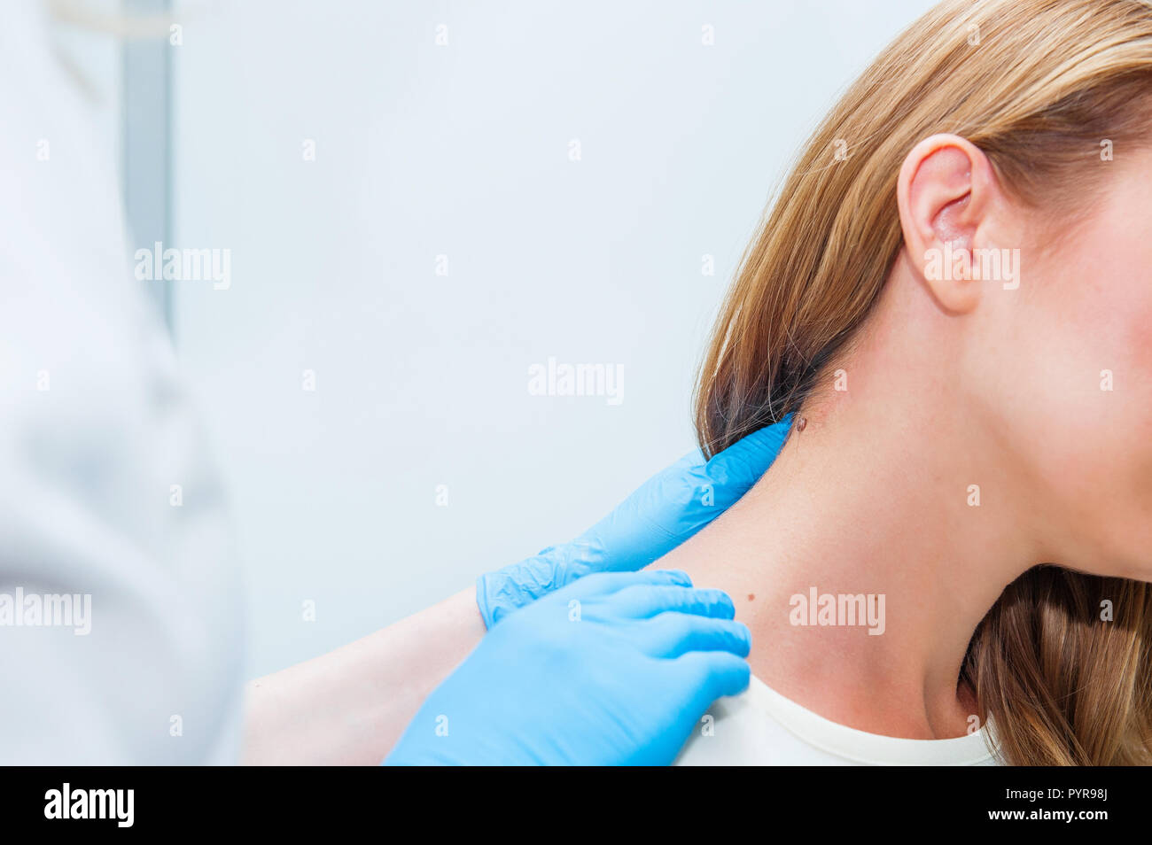 Doctor dermatologist examines birthmark of patient close up. Checking benign moles Stock Photo