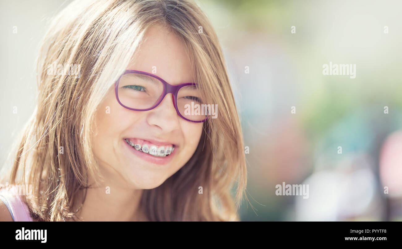 Happy smiling girl with dental braces and glasses. Young cute caucasian blond girl wearing teeth braces and glasses. Stock Photo