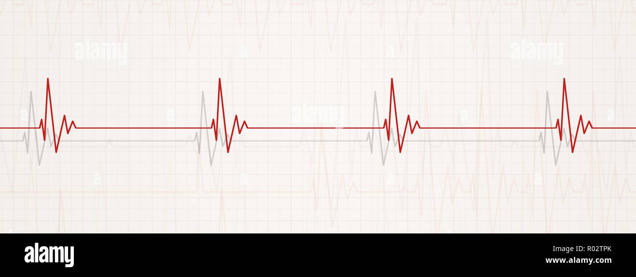 medicine banner illustrating brodycardia. heart rate less than 60 beats per minute Stock Photo