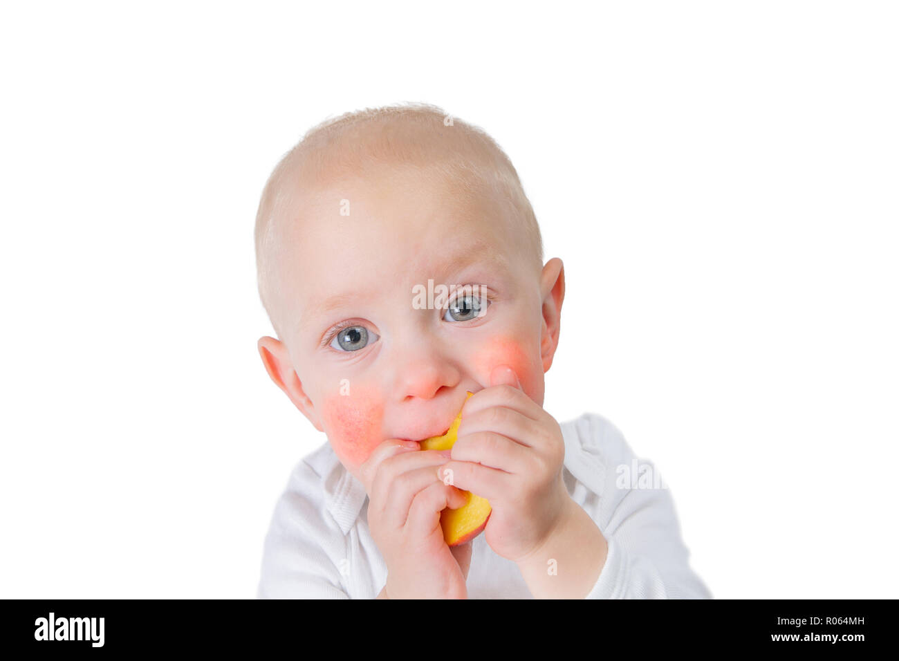 Food allergy concept baby with dermatitis on cheeks, isolated on