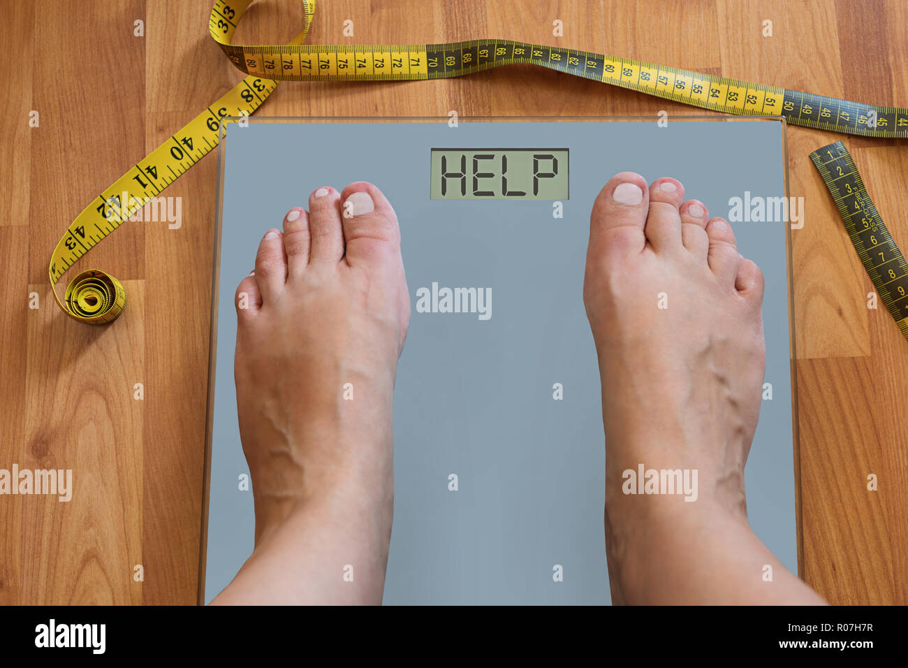 Inflated feet of woman on weighting scale asking for help to lose weight. Diet temptation or hard to lose weight concept Stock Photo