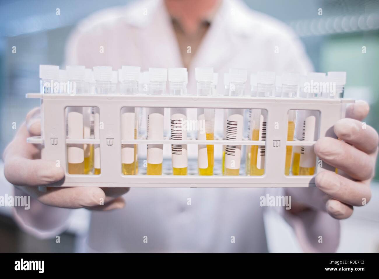 Laboratory assistant holding medical samples in rack. Stock Photo