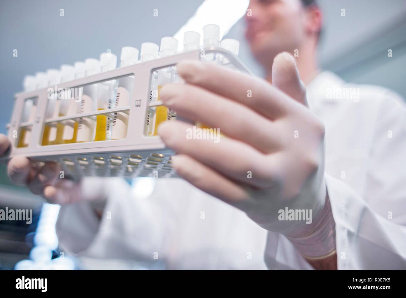 Laboratory assistant holding medical samples in rack. Stock Photo