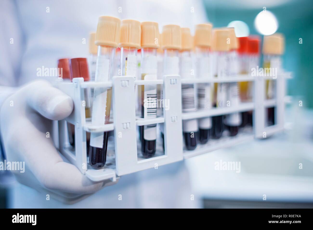 Laboratory assistant holding medical samples in rack, close up. Stock Photo
