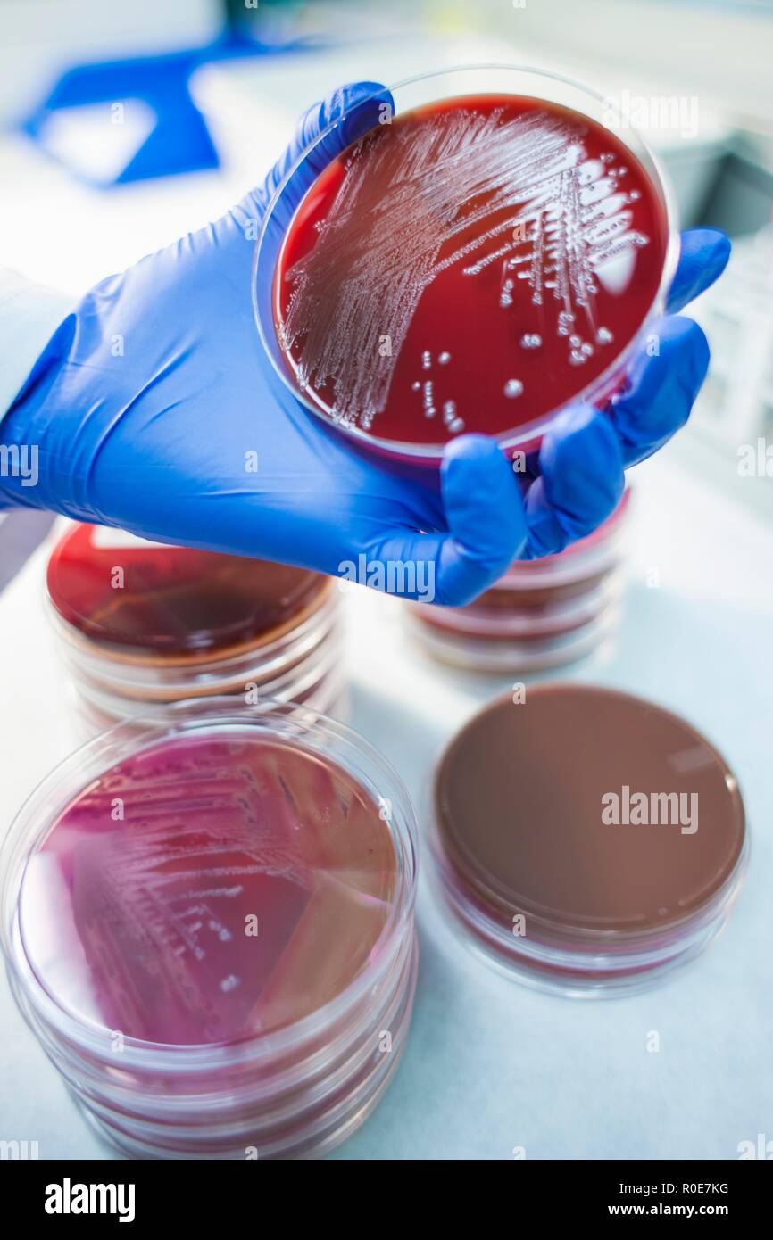 Laboratory assistant examining growth on a petri dish, close up. Stock Photo