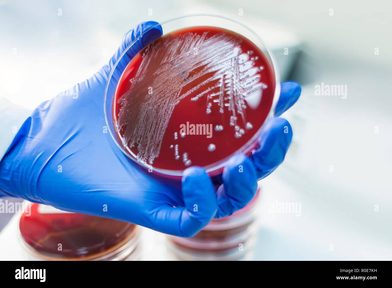 Laboratory assistant examining growth on a petri dish, close up. Stock Photo