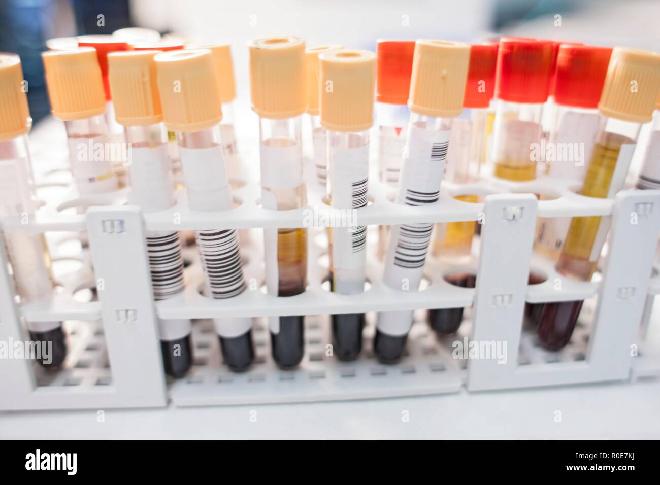 Medical samples in rack, close up. Stock Photo