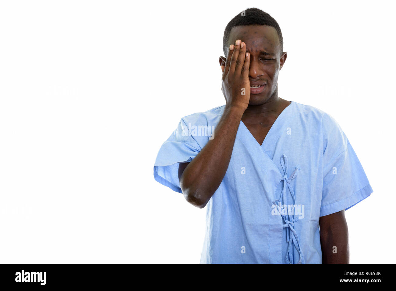 Studio shot of young black African man patient looking sad while Stock Photo