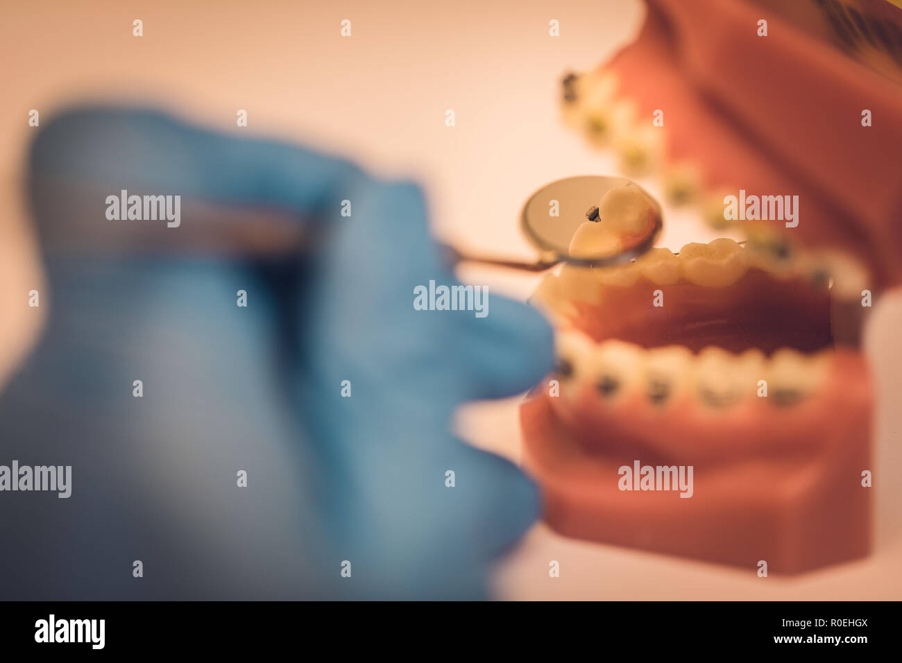 Detailed close up of dental instrument working on a denture or teeth