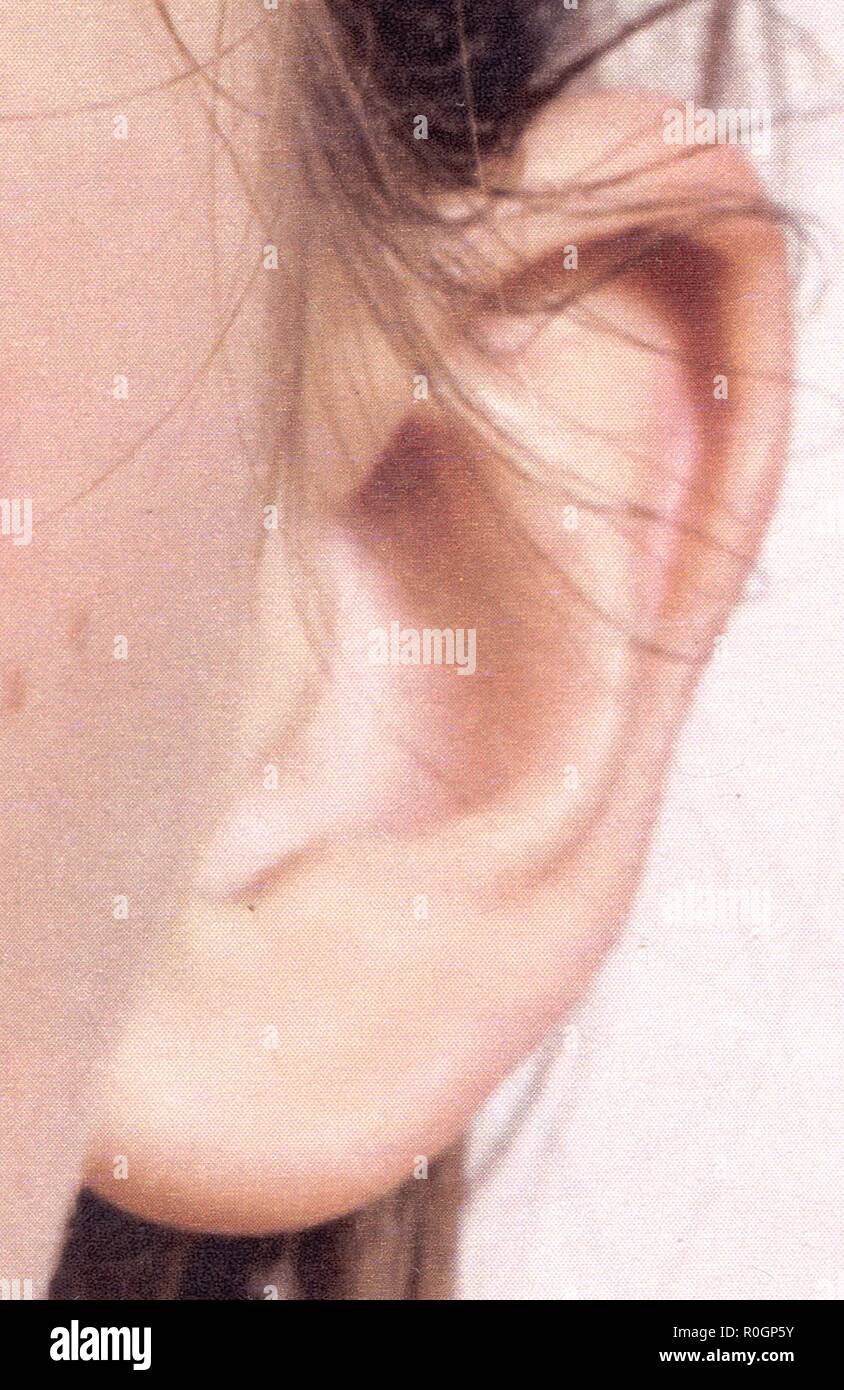 Oreille hires stock photography and images Alamy