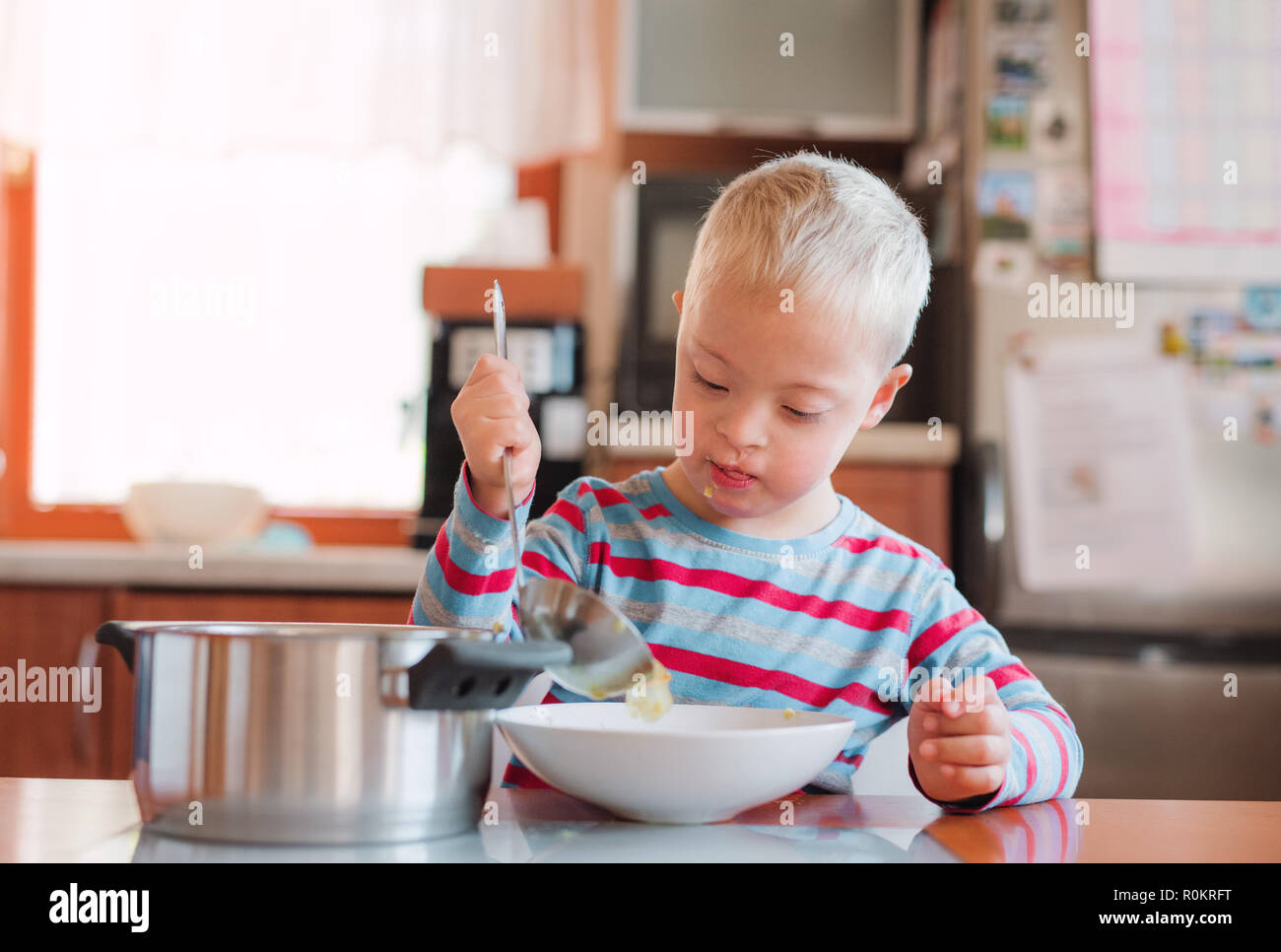 A handicapped down syndrome child pouring soup into a plate indoors. Stock Photo