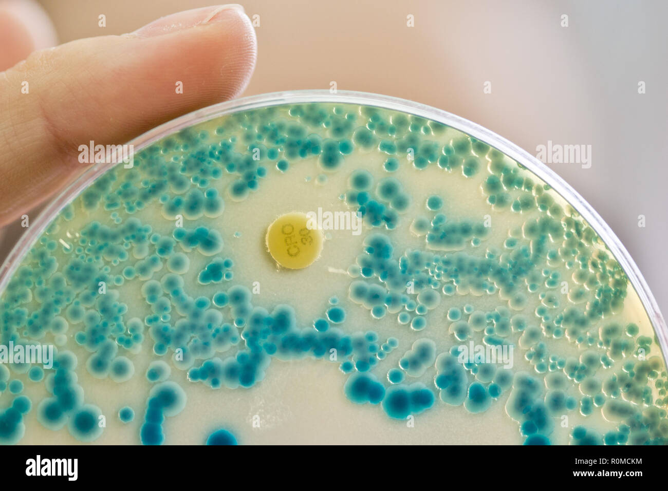 Erlangen, Germany. 21st July, 2015. ILLUSTRATION - A laboratory employee at an institute for clinical microbiology, immunology and hygiene holds an indicator culture plate for the detection of resistant bacteria in her hand in the diagnostic laboratory. Around 33 000 people die each year across Europe as a result of antibiotic resistance. There is no effective antibiotic against the bacteria with which they are infected. (Zu dpa 'Antibiotic resistance causes 33 000 deaths per year in Europe') Credit: Daniel Karmann/dpa/Alamy Live News Stock Photo