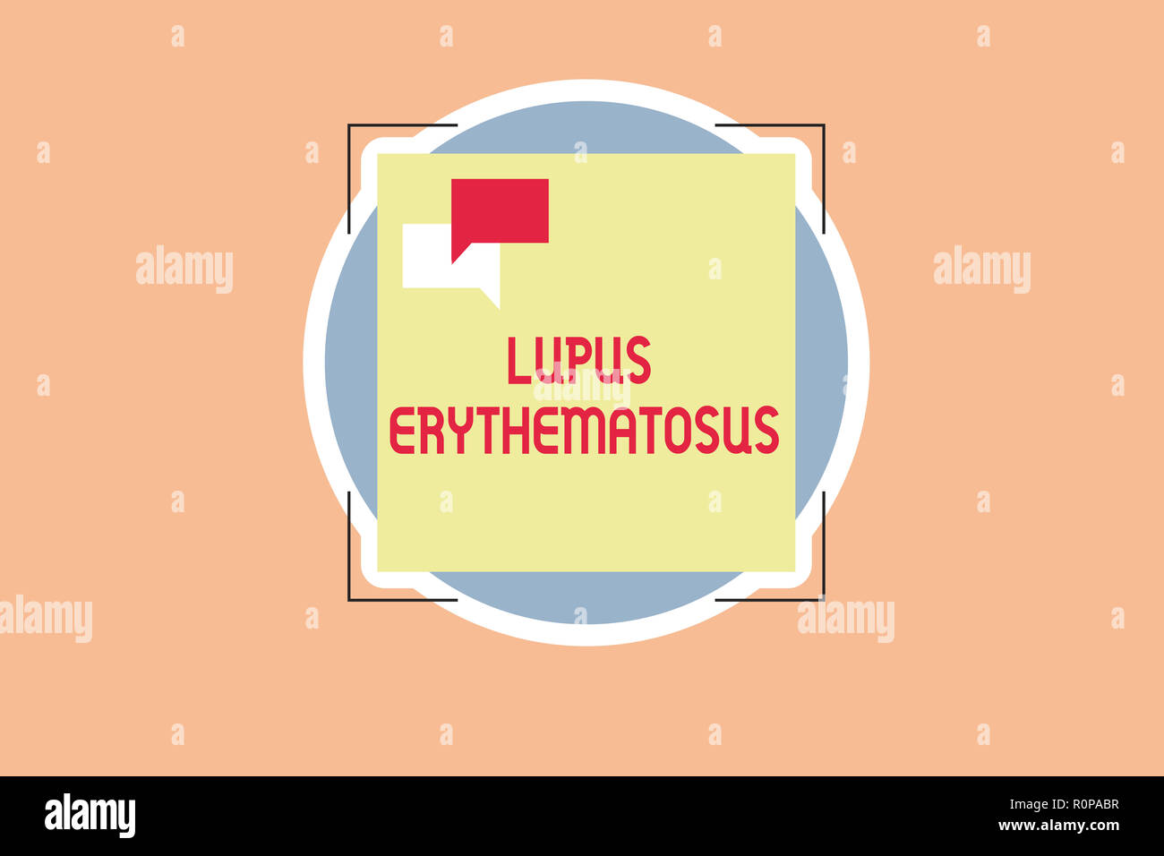 Writing note showing Lupus Erythematosus. Business photo showcasing inflammatory condition caused by an autoimmune disease. Stock Photo