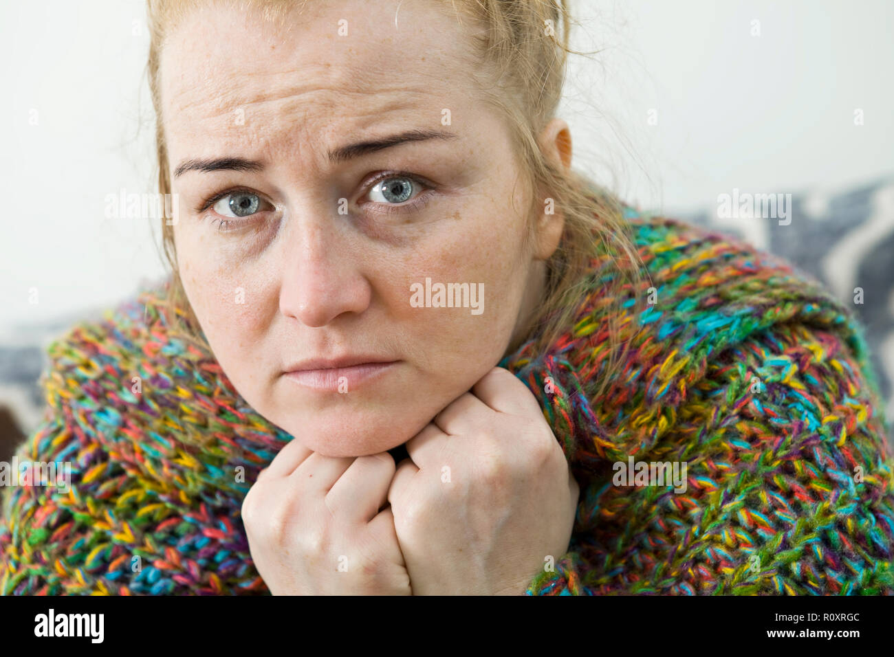 Stressed exhausted young woman having strong tension headache Stock
