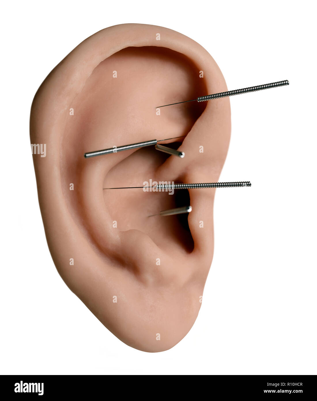 Acupuncture needles on acupoints on ear Stock Photo Alamy