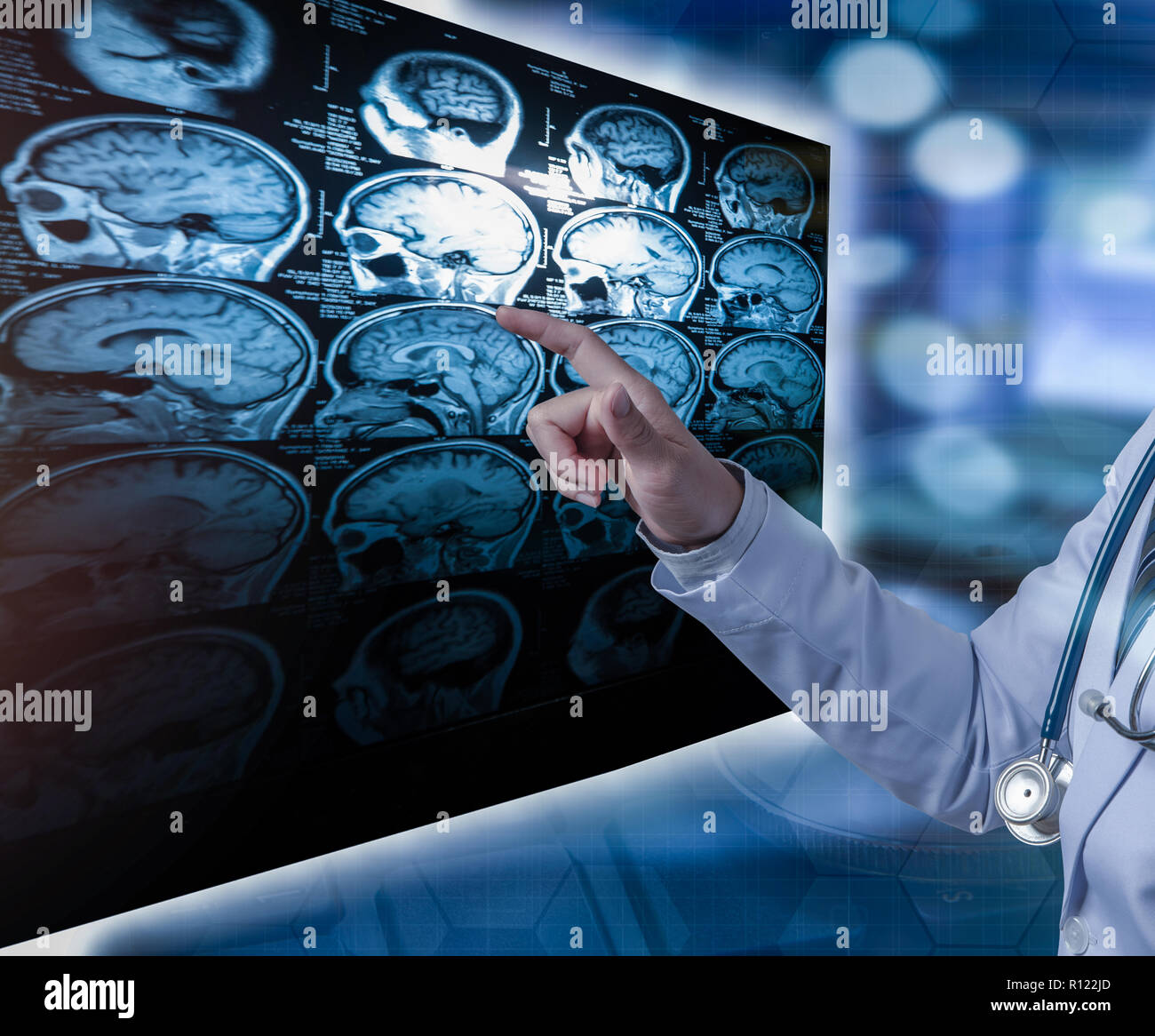 doctor pointing finger to CT scan film, medical concept Stock Photo