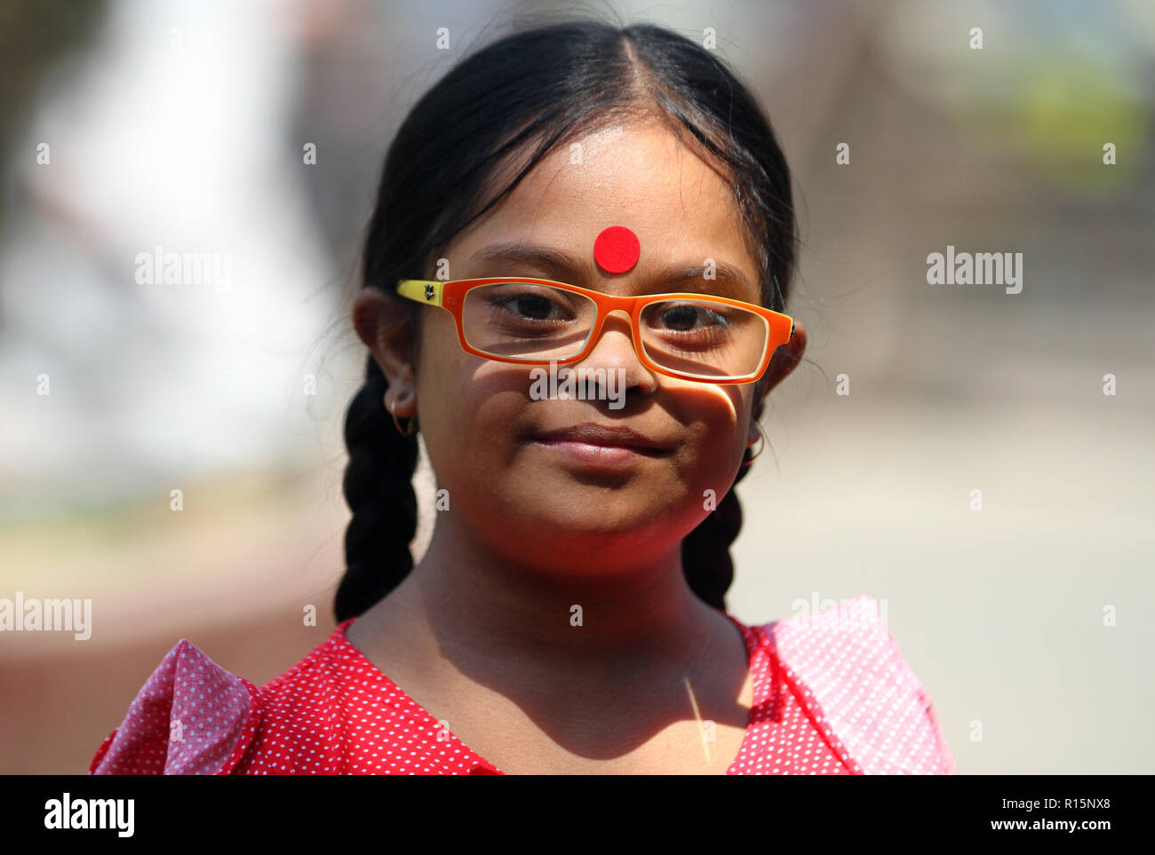 Dhaka, Bangladesh March 21, 2015 Bangladeshi Down syndrome girl at