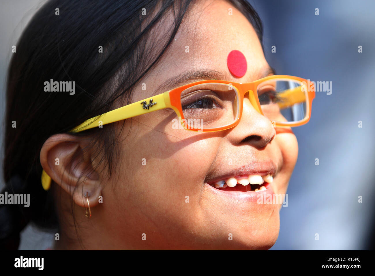 Dhaka, Bangladesh March 21, 2015 Bangladeshi Down syndrome girl at