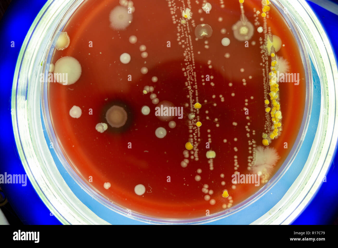 Petri dish with colonies of microbes. Stock Photo