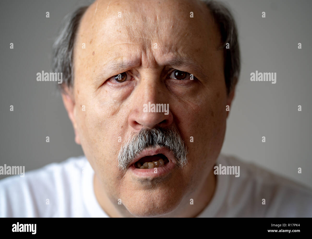 Close up portrait of senior man looking confused and lost suffering from dementia, memory loss or Alzheimer in Mental health in Older Adults and later Stock Photo