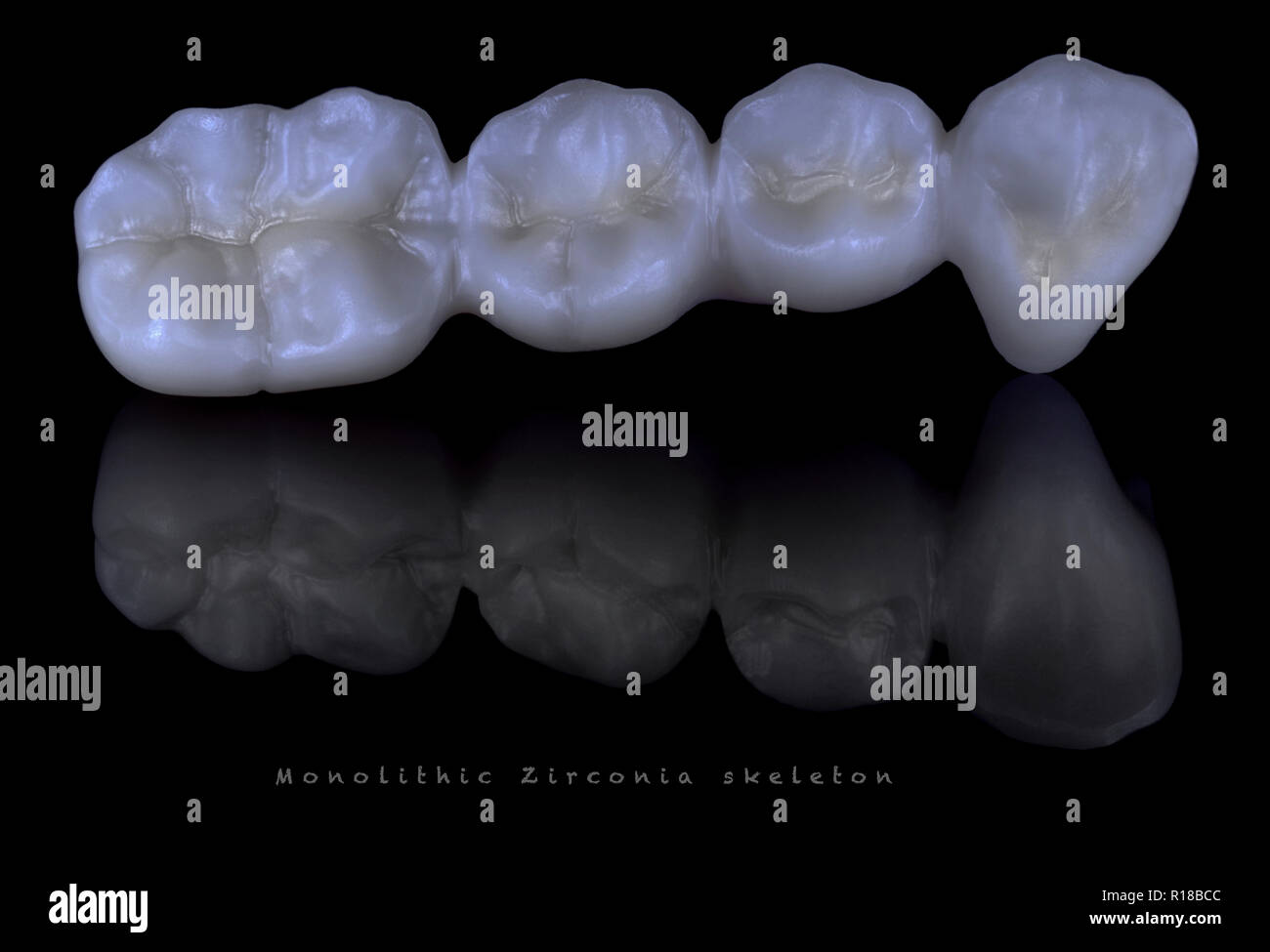 Ceramic zirconia teeth Stock Photo Alamy