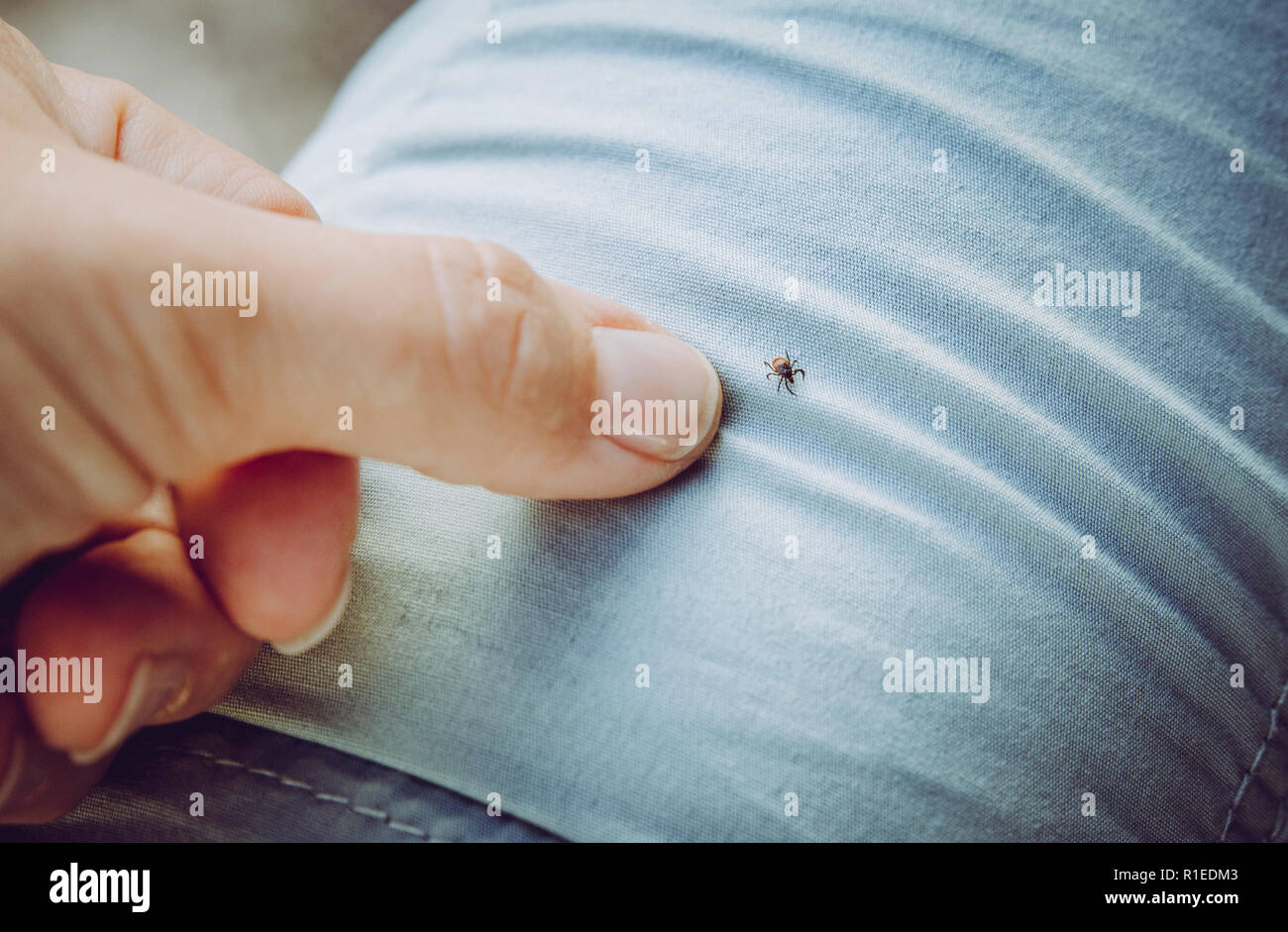 Dangerous diseases hi-res stock photography and images - Alamy
