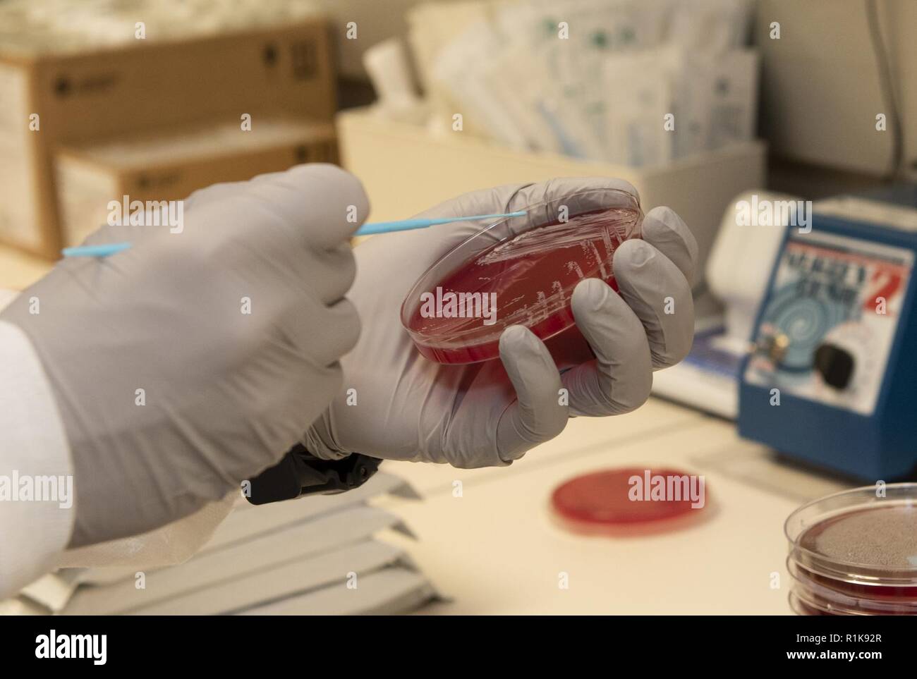 Strep throat culture hires stock photography and images Alamy