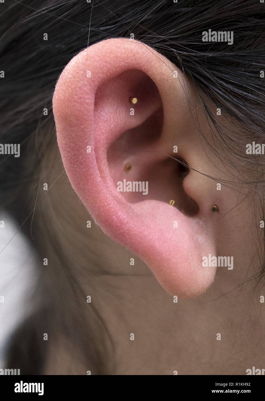 A closeup photo of Battle Field Acupuncture on the ear of Senior