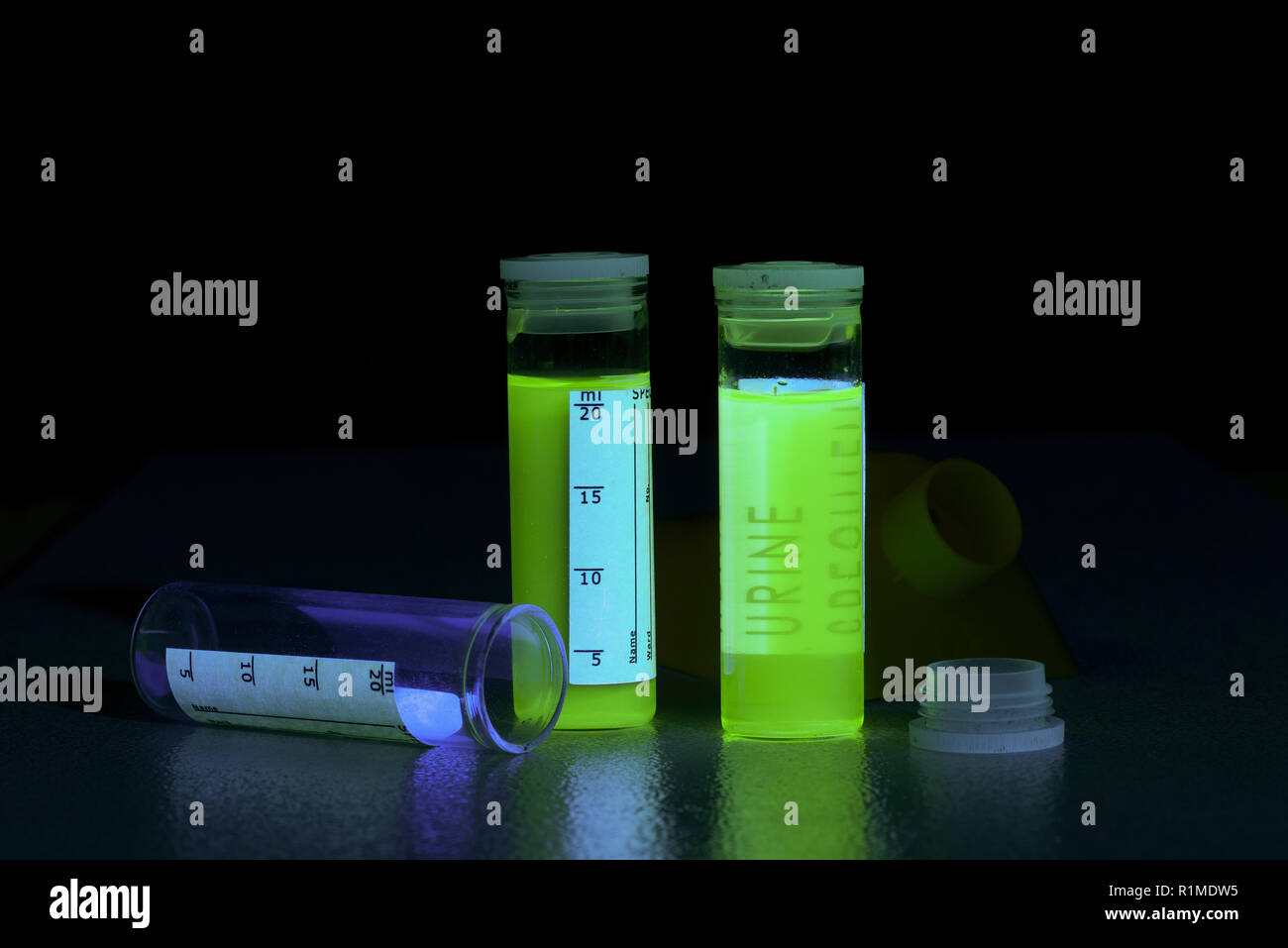 Excessive drinking of Bvitamins, resulting in highly fluorescing urine