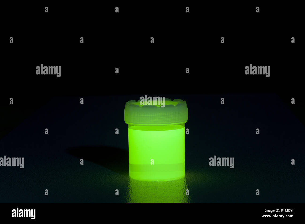 Excessive drinking of Bvitamins, resulting in highly fluorescing urine