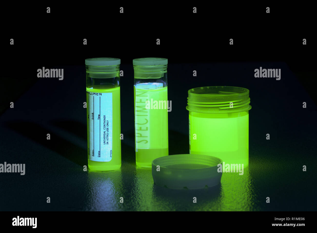 Excessive drinking of Bvitamins, resulting in highly fluorescing urine