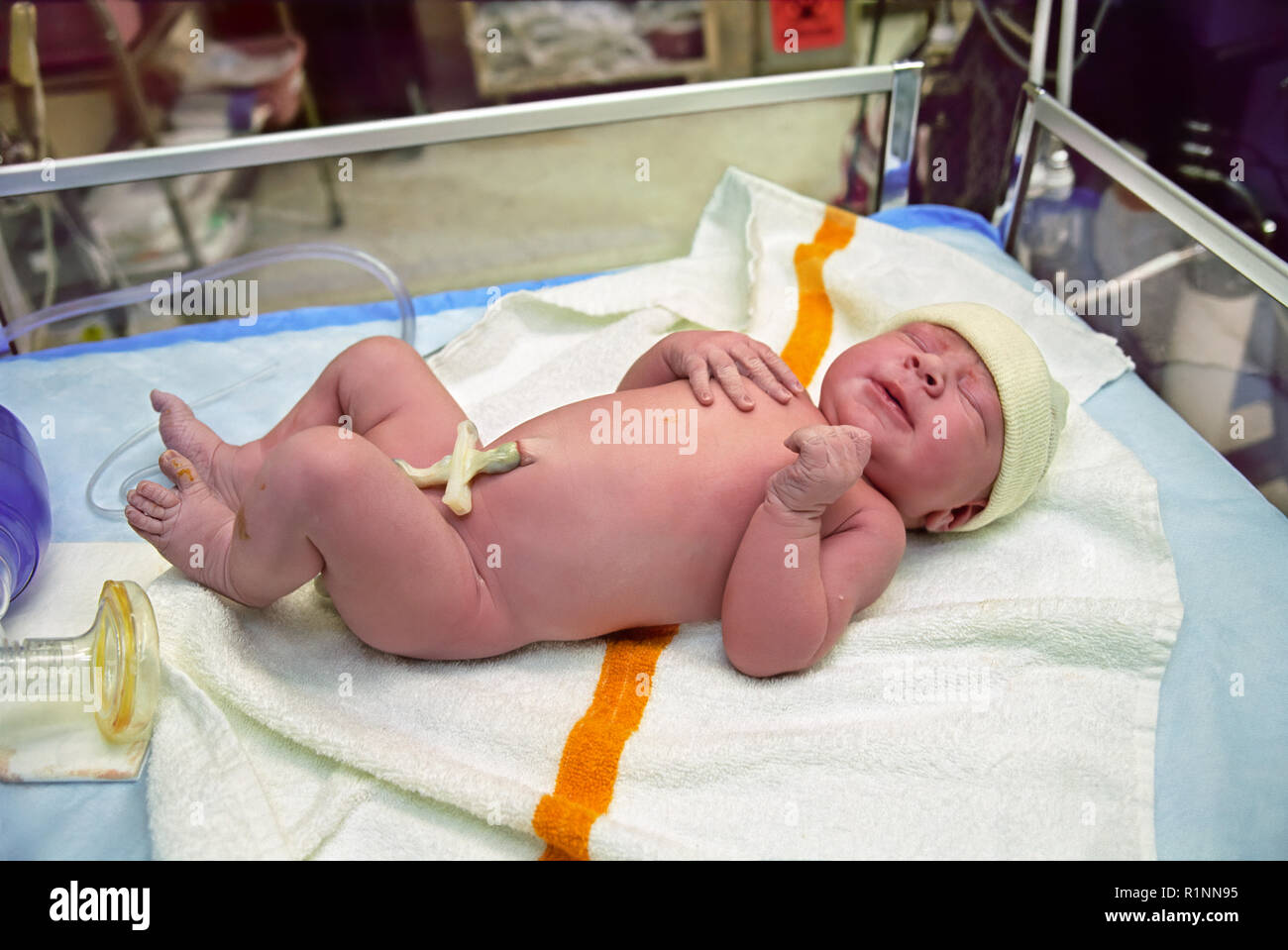 A newborn baby in the operating room just cleaned after a cesarean section Stock Photo