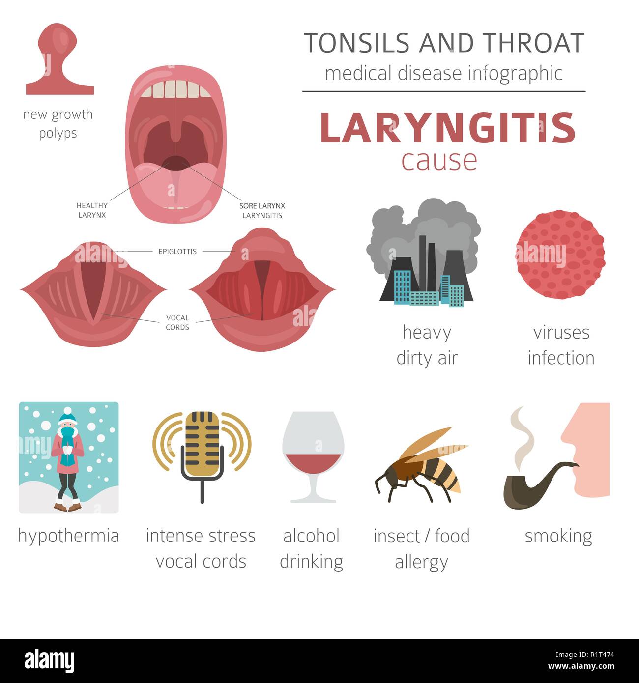 Tonsils and throat diseases. Laryngitis symptoms, treatment icon set