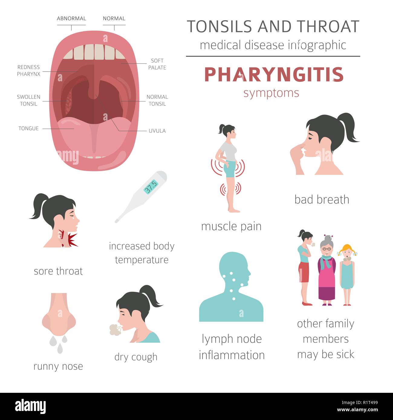 Tonsils And Throat Diseases Pharyngitis Symptoms Treatment Icon Set Medical Infographic