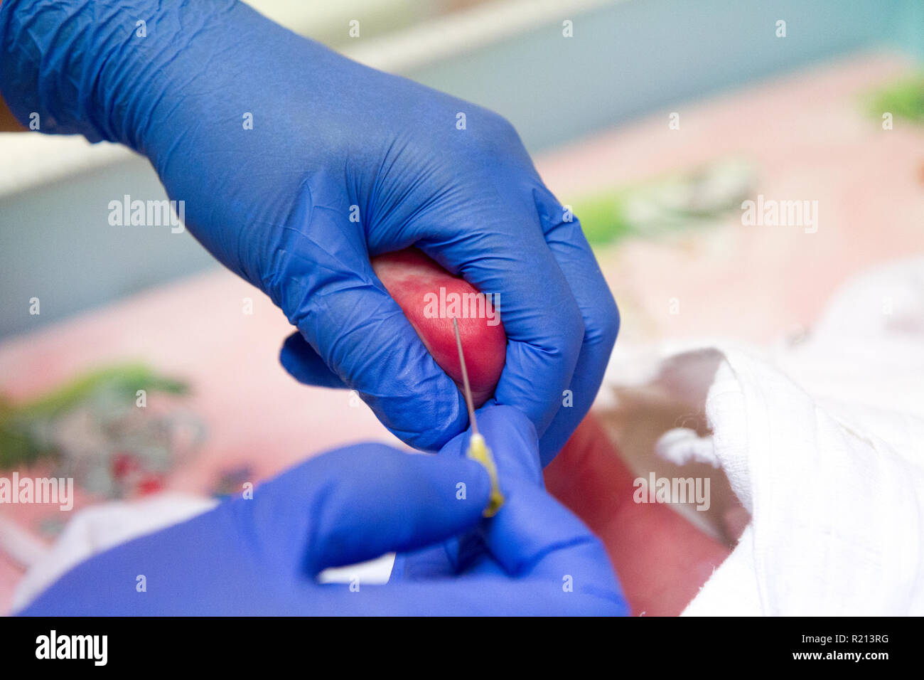 Newborn blood spot (heel prick) test (the Guthrie' test). A physician
