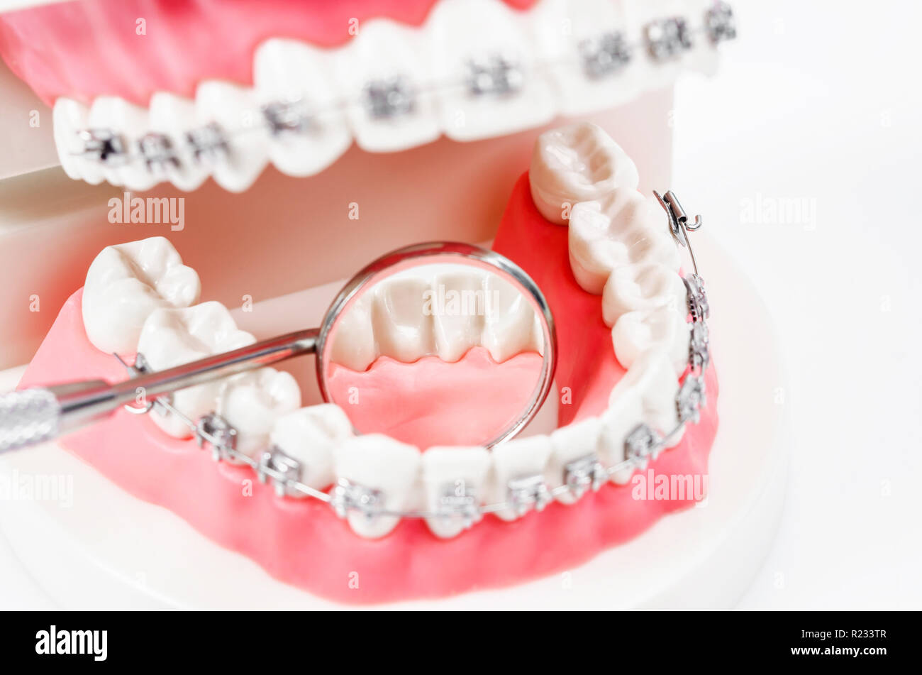 tooth model with metal wire dental braces and mirror dental equipment ...