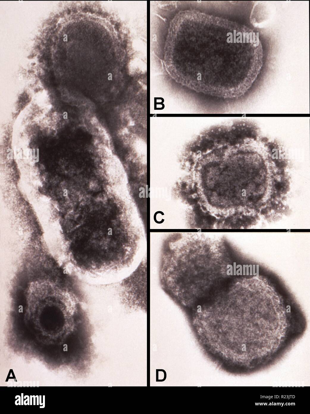 High magnification of 150,000X, negatively-stained transmission electron micrograph (TEM) revealing some of the ultrastructure morphology exhibited by a number of different microorganisms. Panel 'A' represents a composite micrograph, for comparing the size difference between a poxvirus at the top, a bacillus in the middle and a herpesvirus at the bottom. Panels 'B', 'C' and 'D' are TEMs depicting the sequential degeneration of variola virus patricles. Stock Photo