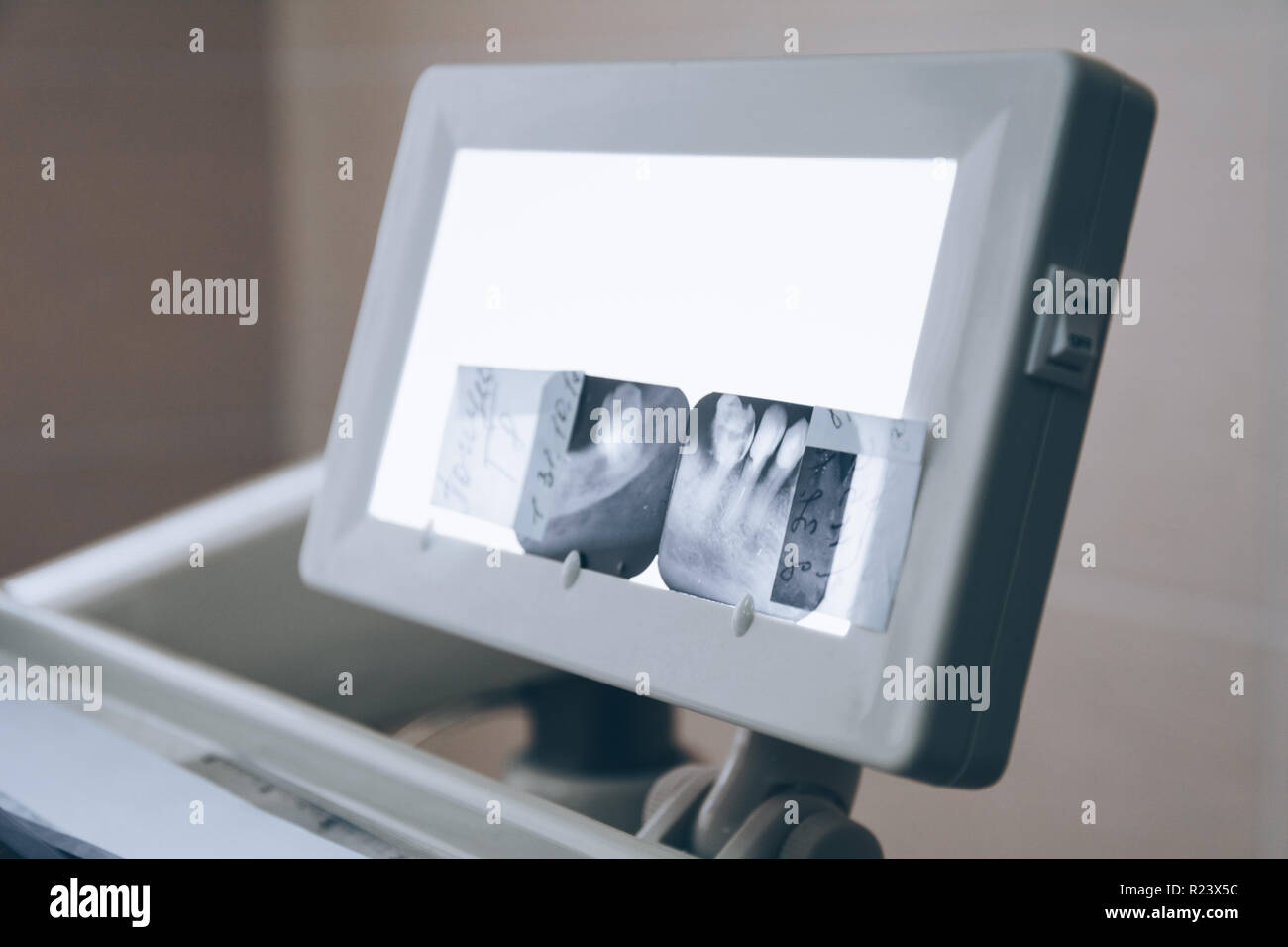  X-ray picture on led background. Dental care, dental hygiene, checkup Bildidee 