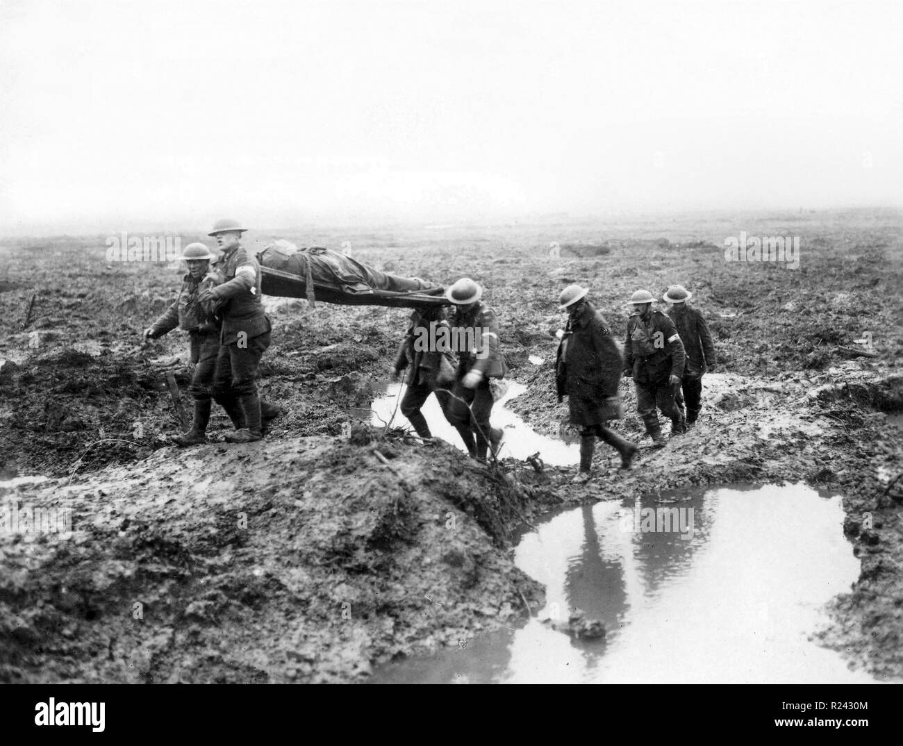 Canadian soldiers wounded at the Second Battle of Passchendaele was the culminating attack during the Third Battle of Ypres of the First World War. between 26 October and 10 November 1917 Stock Photo