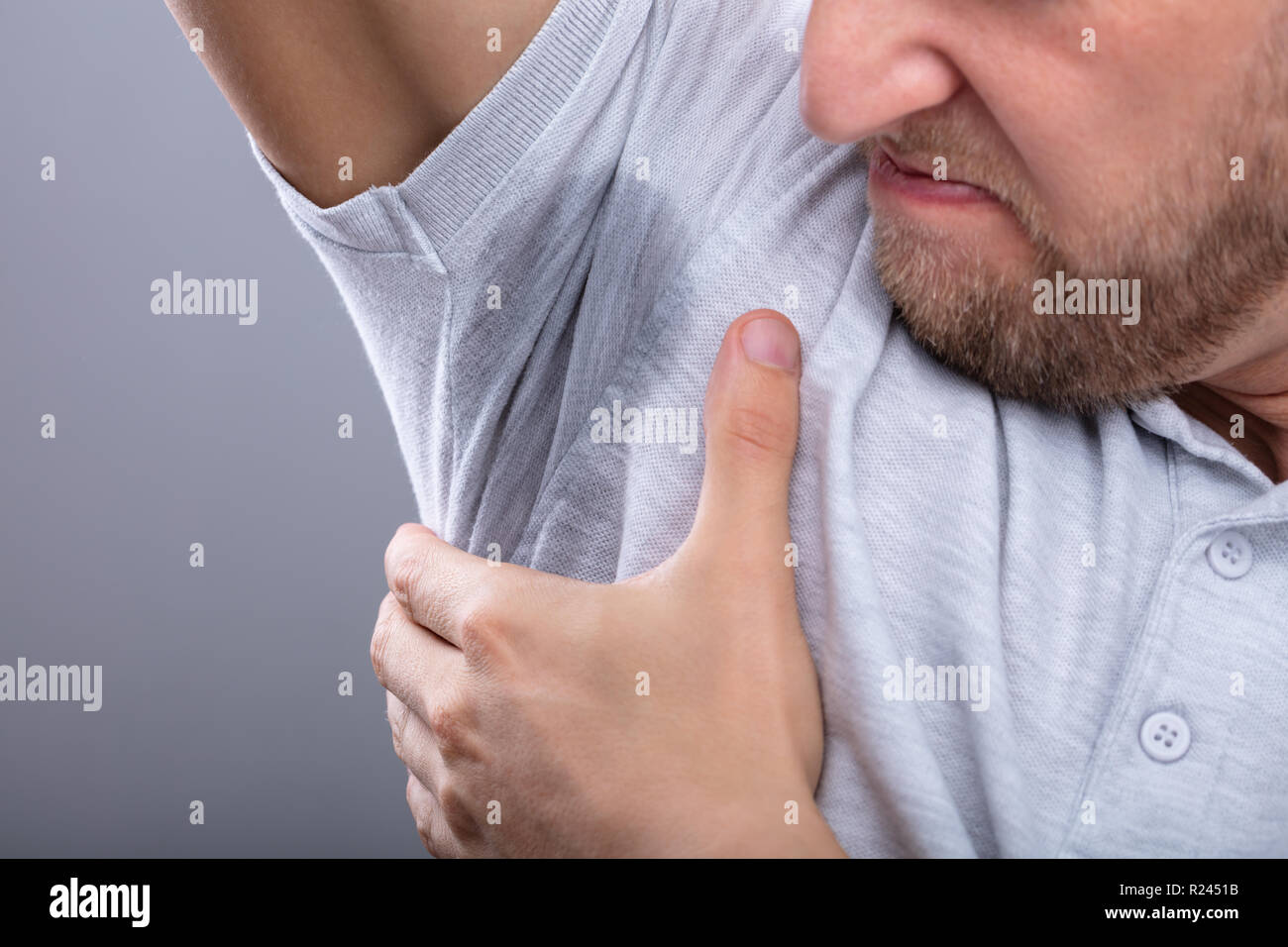 Man With Hyperhidrosis Sweating Very Badly Under Armpit Stock Photo