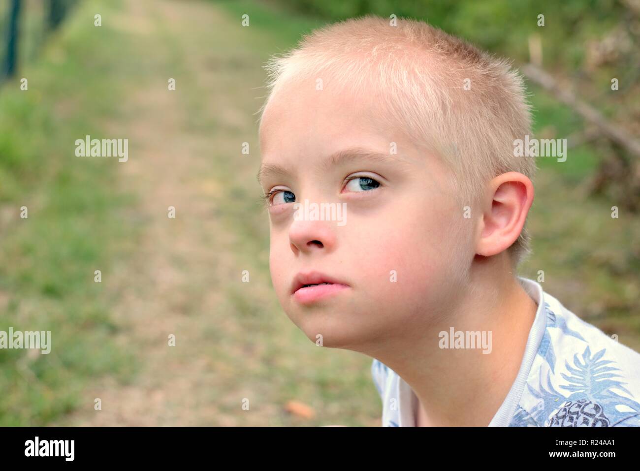 Defect,childcare,medicine and people concept- boy with down syndrome poses for a portrait outdoors. Stock Photo