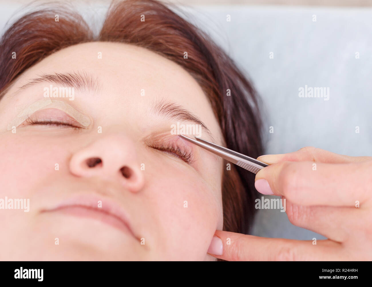 Surgeon applies a bandage to the female patient's eyelids after Stock
