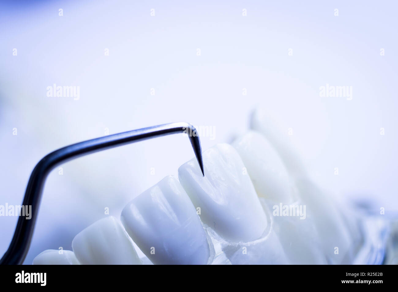 Dentist cleaning teeth with titanium metal tooth pick instrument to